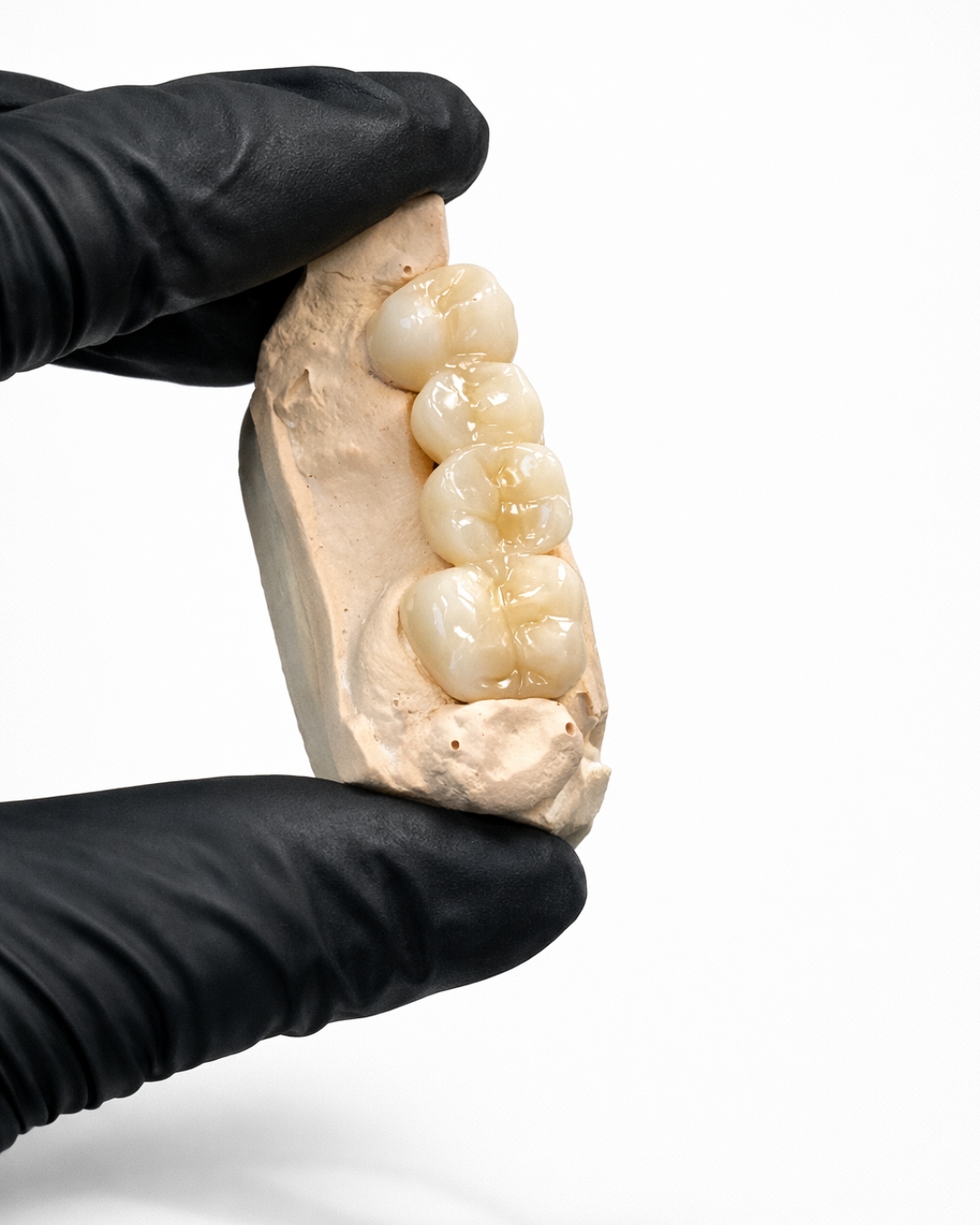 Zirconia Crown detail